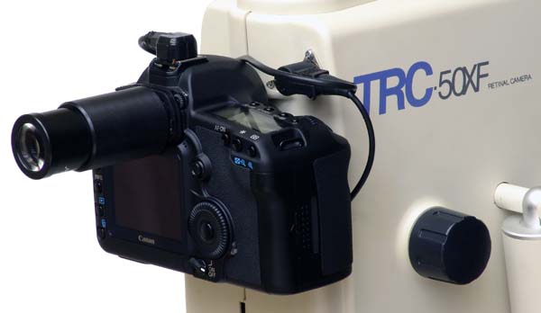 Canon digital camera attached to Topcon TRC-50XF