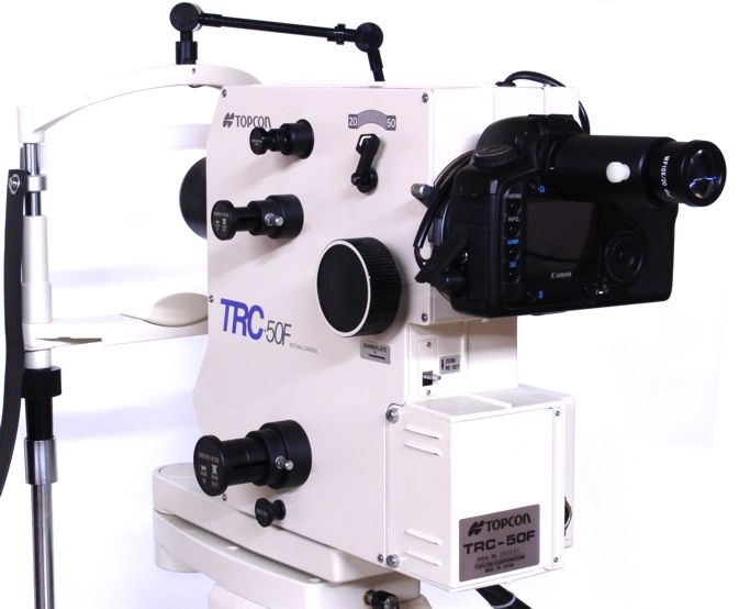 Topcon TRC-50F with digital camera upgrade