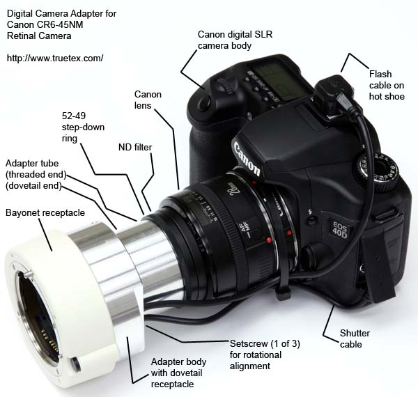 Canon CR6-45NM Non-Mydriatic Retinal Camera Digital Upgrade Kit